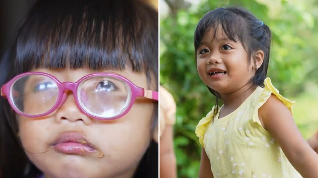 resposta-de-oracao:-missao-restaura-visao-de-menina-de-3-anos-com-catarata