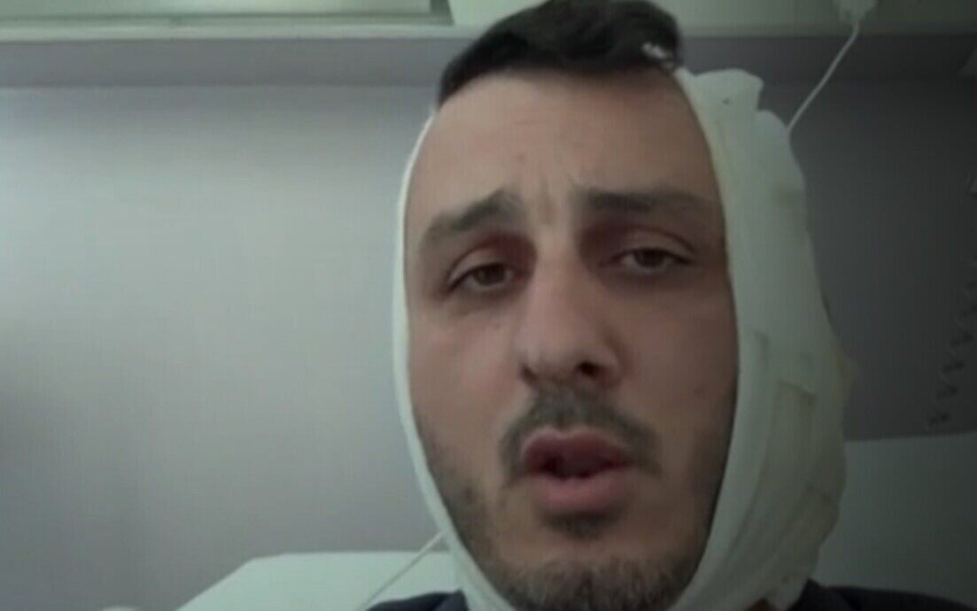 turista-israelense-tem-orelha-arrancada-na-grecia-por-homem-que-gritou:-“eu-sou-o-hamas”
