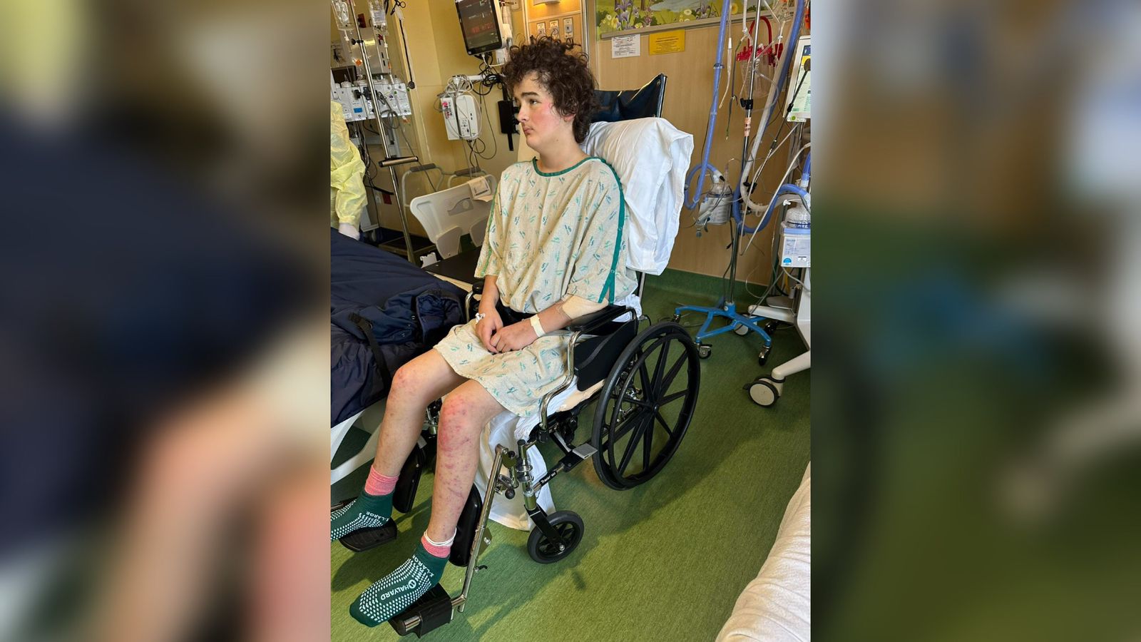 menino-sobrevive-a-queda-de-73-metros-e-acorda-apos-11-dias-em-coma:-“ele-e-um-milagre”