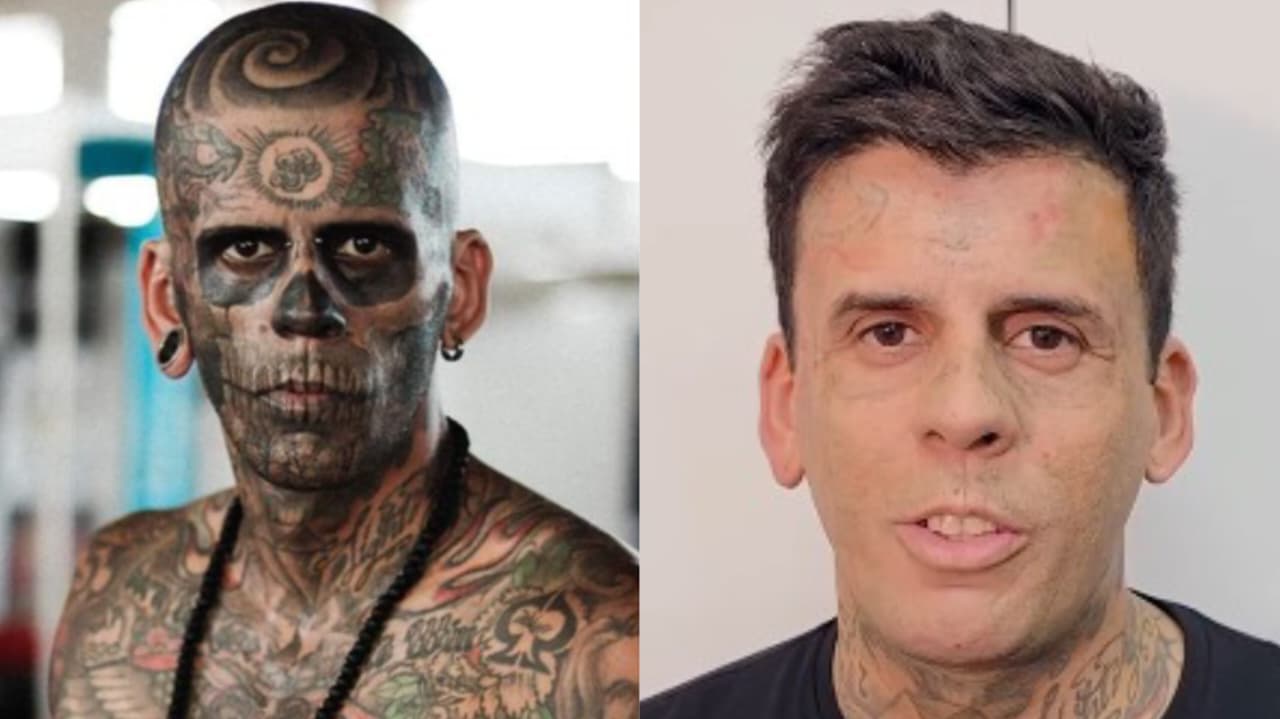 homem-mais-tatuado-do-brasil-que-se-converteu-remove-tatuagens-do-rosto:-“e-sobre-jesus”