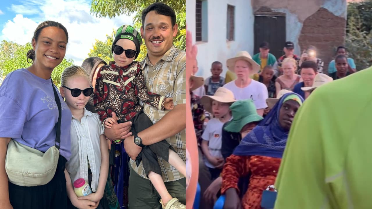 missionarios-brasileiros-ajudam-albinos-perseguidos-na-africa:-“correm-risco-de-sequestro”