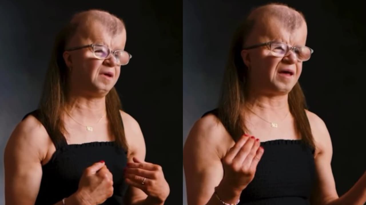 mulher-com-sindrome-que-causa-morte-precoce-testemunha:-“vivo-cada-dia-como-uma-bencao”